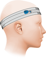 Слуховые аппараты костной проводимости